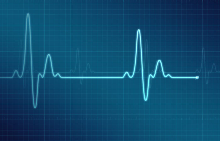 Illustration of an electrocardiogram